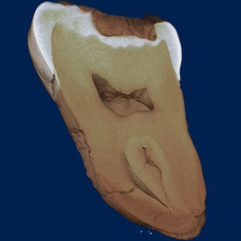 Коренной зуб